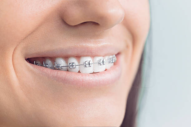 Professional Holistic Dental Care Services in Aberdeen Proving Ground, MD
